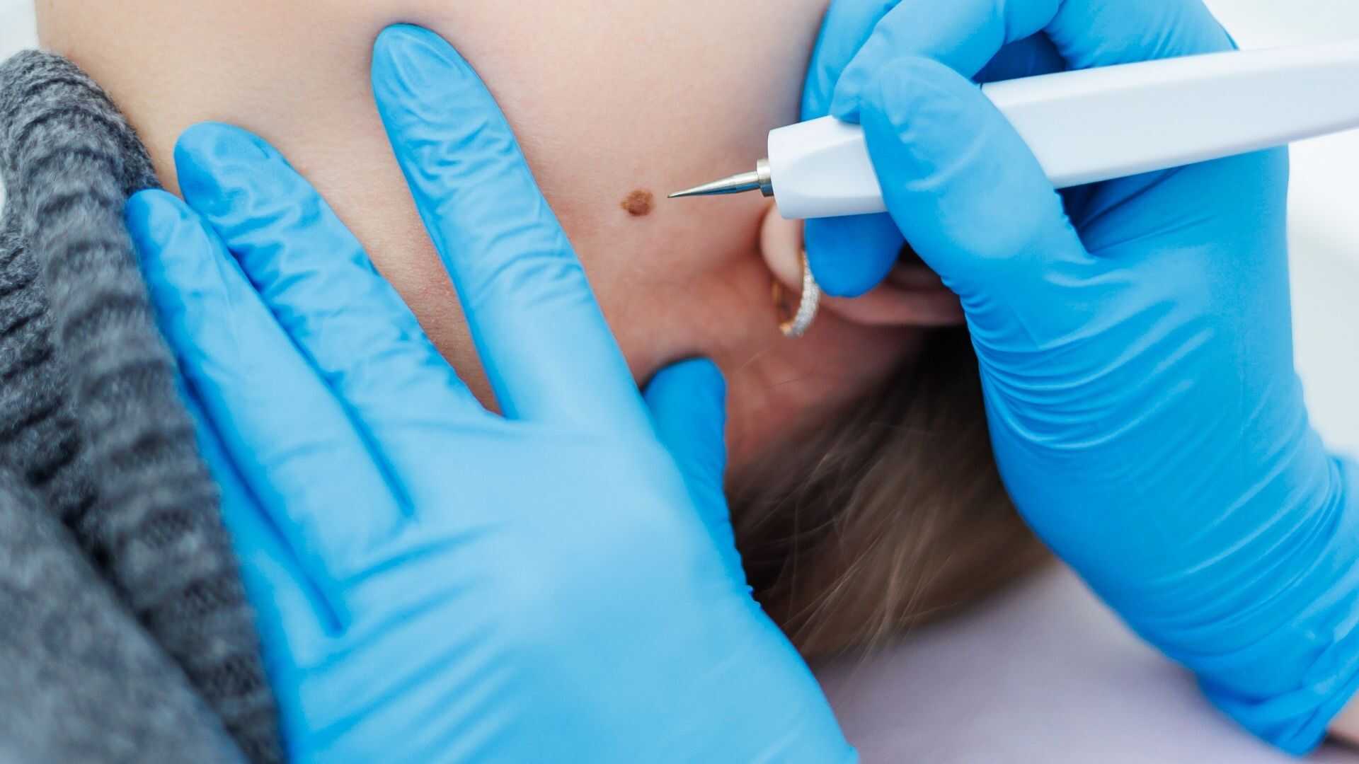 Pequenas Cirurgias em Geral | Gastromed